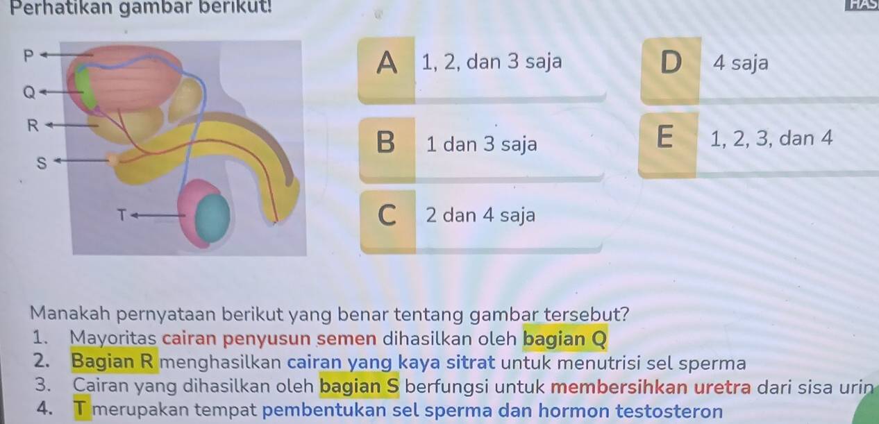 Perhatikan gambar berikut!
A 1, 2, dan 3 saja D 4 saja
B 1 dan 3 saja
E 1, 2, 3, dan 4
C 2 dan 4 saja
Manakah pernyataan berikut yang benar tentang gambar tersebut?
1. Mayoritas cairan penyusun semen dihasilkan oleh bagian Q
2. Bagian R menghasilkan cairan yang kaya sitrat untuk menutrisi sel sperma
3. Cairan yang dihasilkan oleh bagian S berfungsi untuk membersihkan uretra dari sisa urin
4. T merupakan tempat pembentukan sel sperma dan hormon testosteron