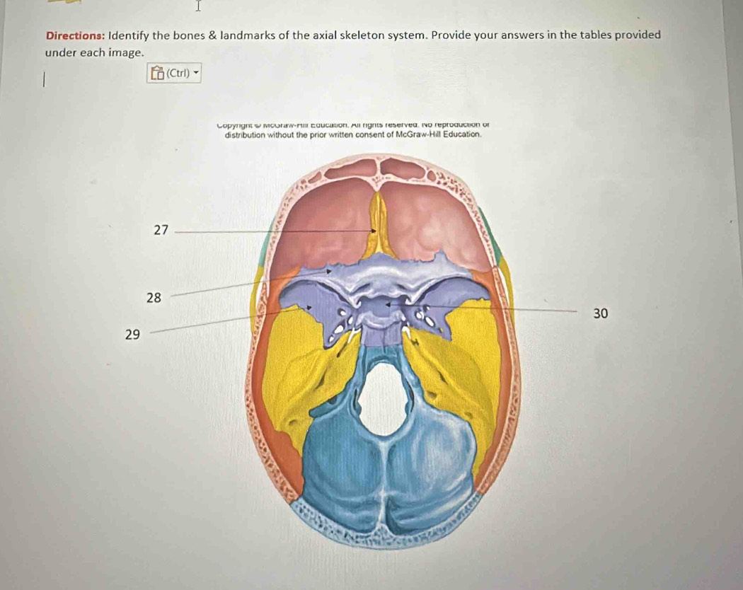 Directions: Identify the bones & landmarks of the axial skeleton system. Provide your answers in the tables provided 
under each image. 
(Ctrl) 
Copyright & Mcoraw-Hlll Education. All rights reserved. No reproduction or 
distribution without the prior written consent of McGraw-Hill Education.