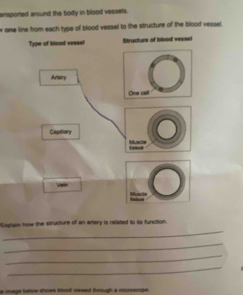 ansported around the body in blood vessels. 
w one line from each type of blood vessel to the structure of the blood vessel, 
Type of blood vessel Structure of blood vessel 
Artery 
One call 
Capiliary 
Muscle 
tissue 
Vein 
_ 
Explain how the structure of an artery is related to its function. 
_ 
_ 
_ 
e image below shows blood viewed through a microscope.