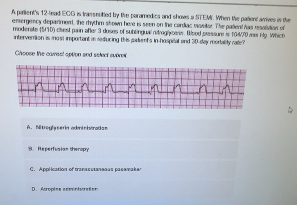 Solved: A patient's 12 -lead ECG is transmitted by the paramedics and ...