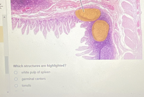 Which structures are highlighted?
white pulp of spleen
germinal centers
tonsils