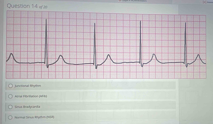 [H] Asses
Junctional Rhythm
Atrial Fibrillation (AFib)
Sinus Bradycardia
Normal Sinus Rhythm (NSR)