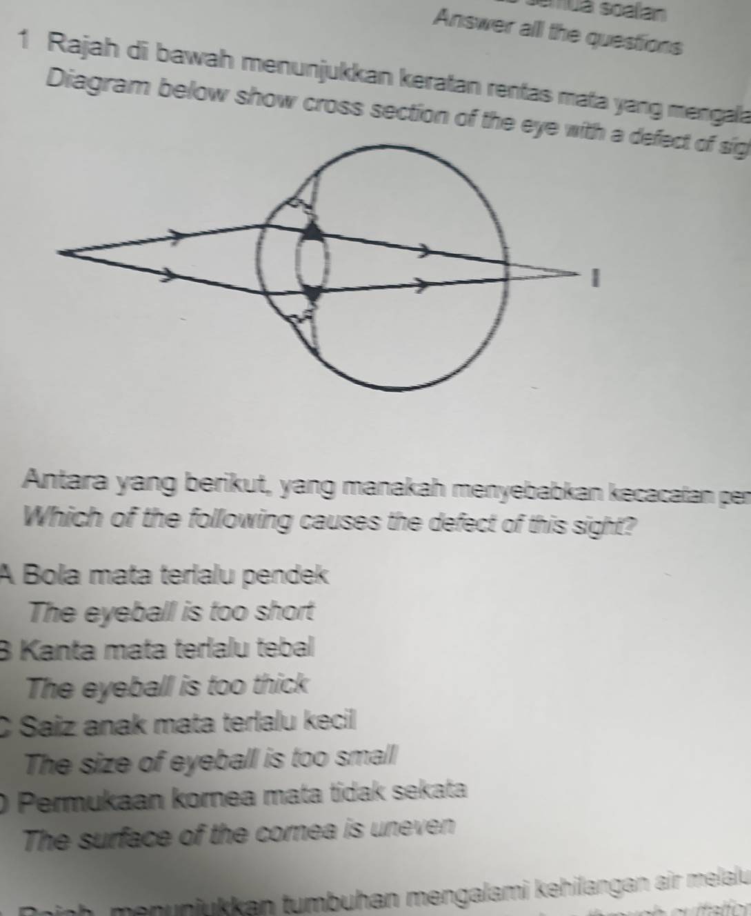 smuá soalan
Answer all the questions
1 Rajah di bawah menunjukkan keratan rentas mata yang mengala
Diagram below show cross section of the eye witefect of sig
Antara yang berikut, yang manakah menyebabkan kecacatan per
Which of the following causes the defect of this sight?
A Bola mata terlalu pendek
The eyeball is too short
B Kanta mata terlalu tebal
The eyeball is too thick
C Saiz anak mata terlalu kecil 
The size of eyeball is too small
Permukaan kornea mata tidak sekata
The surface of the cornea is uneven
inh menunjükkan tumbuhan mengalami kehilangan air melalu