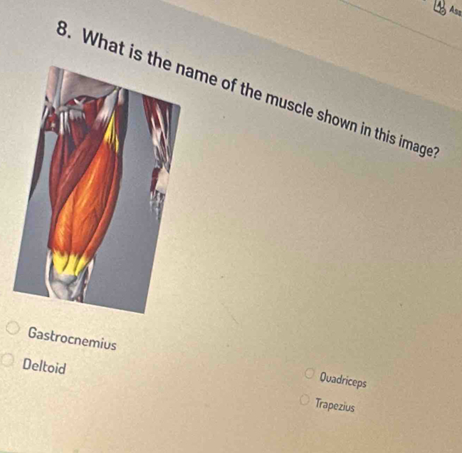 A Ass 
3. What is tme of the muscle shown in this image 
Gastrocnemius Quadriceps 
Deltoid Trapezius