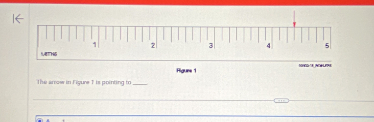 Rgure 1 
The arrow in Figure 1 is pointing to_ 
_