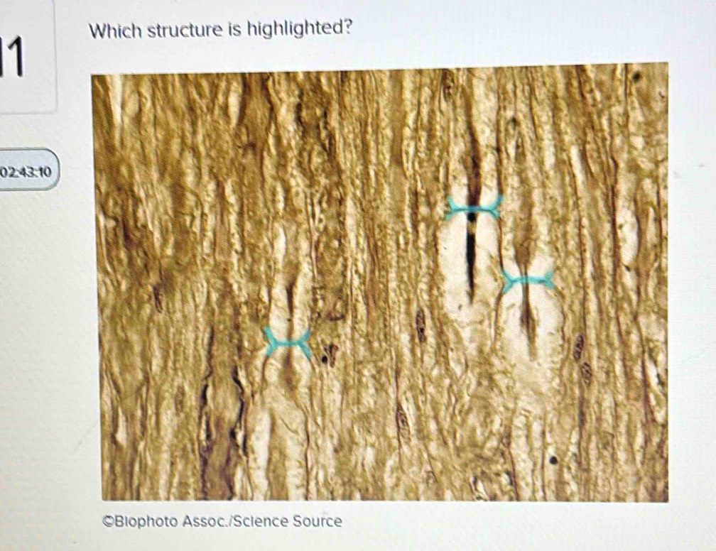 Which structure is highlighted? 
1
02.43:10
©Blophoto Assoc./Science Source