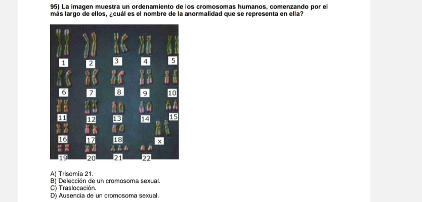 La imagen muestra un ordenamiento de los cromosomas humanos, comenzando por el
más largo de ellos, ¿cuál es el nombre de la anormalidad que se representa en ella?
A) Trisomía 21.
B) Delección de un cromosoma sexual.
C) Traslocación.
D) Ausencia de un cromosoma sexual.