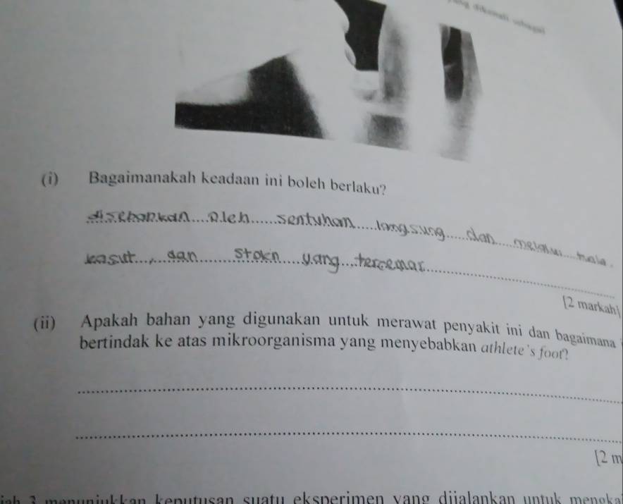 Tnati vchag 
(i) Bagaimanakah keadaan ini boleh berlaku? 
a n d ß . ß c h . 
_ 
e .. huale 
dan S t a 
[2 markah] 
(ii) Apakah bahan yang digunakan untuk merawat penyakit ini dan bagaimana 
bertindak ke atas mikroorganisma yang menyebabkan athlete 's foot? 
_ 
_ 
[2 m 
a p u t san su a tu e sperimen v a di lankan