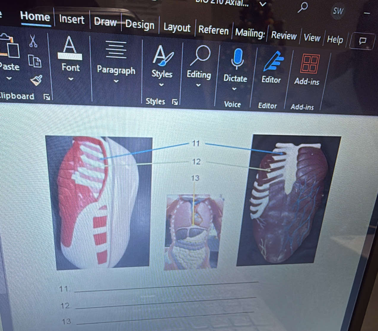 1o Axial.... 
sw 
Home Insert Draw- Design Layout Referen Mailing: Review View Help 
aste Font Paragraph Styles Editing Dictate Editor Add-ins 
lipboard Styles Add-ins 
Voice Editor 
11. 
_ 
12 
_ 
13 
_