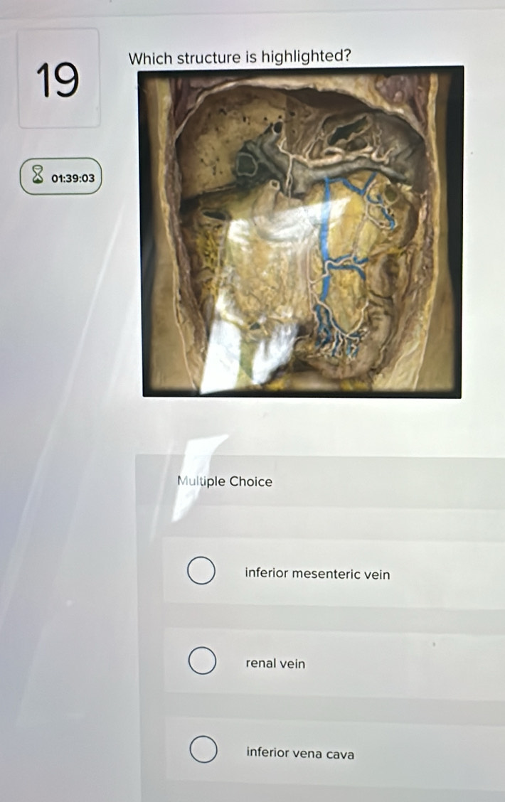 Which structure is highlighted?
19
01:39:03
Multiple Choice
inferior mesenteric vein
renal vein
inferior vena cava