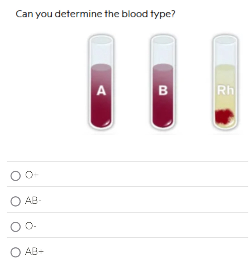 Can you determine the blood type?
A
B
Rh
O+
A 1
O-
AB+