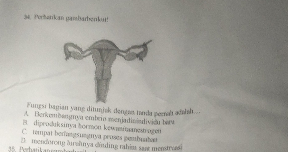 Perhatikan gambarberikut!
Fungsi bagian yang ditunjuk dengan tanda pernah adalah....
A. Berkembangnya embrio menjadinindividu bàru
B. diproduksinya hormon kewanitaanestrogen
C. tempat berlangsungnya proses pembuahan
D. mendorong luruhnya dinding rahim saat menstruasi