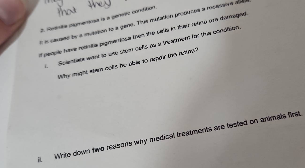 Retinitis pigmentosa is a genetic condition 
t is caused by a mutation to a gene. This mutation produces a recessive alle 
If people have retinitis pigmentosa then the cells in their retina are damaged 
Scientists want to use stem cells as a treatment for this condition 
Why might stem cells be able to repair the retina? 
. Write down two reasons why medical treatments are tested on animals first