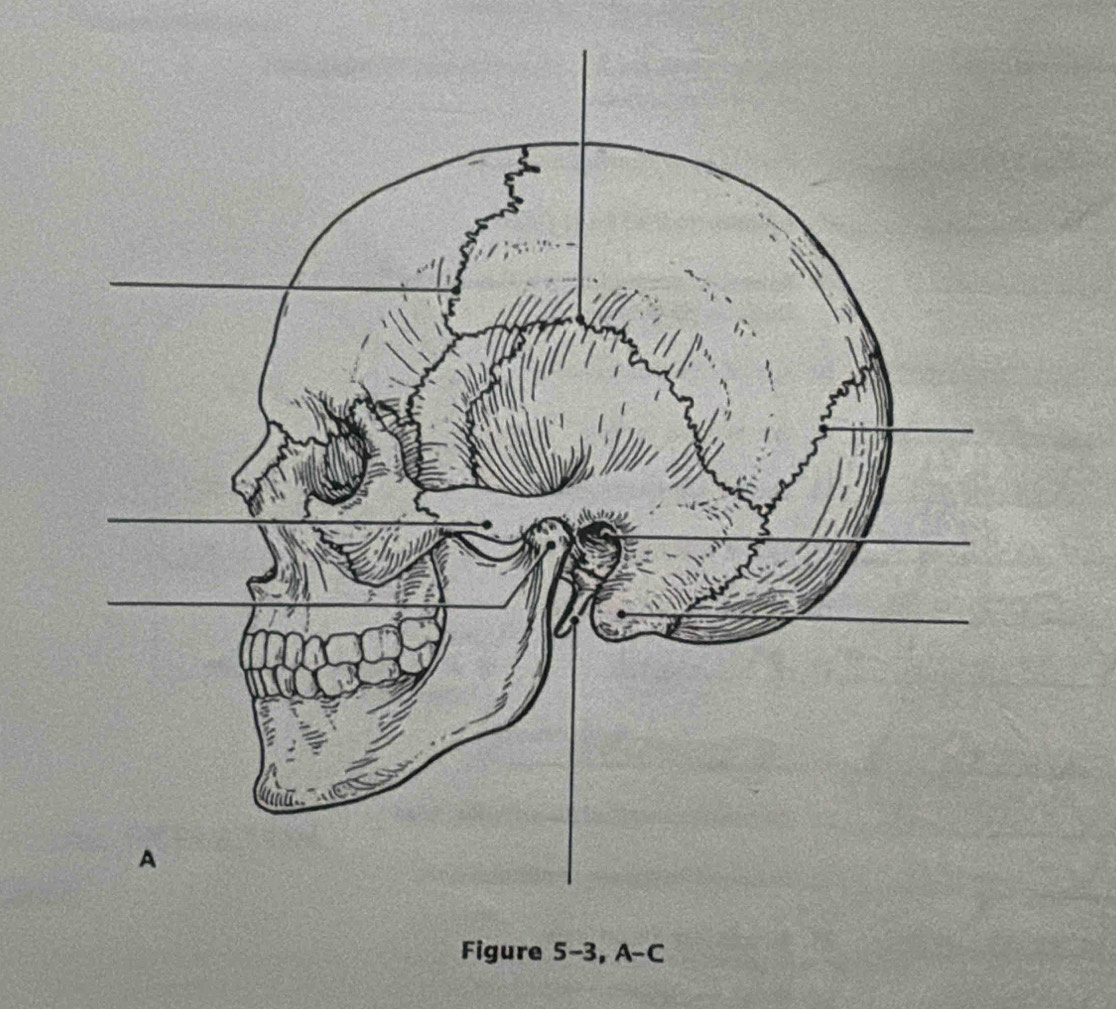 Figure 5-3, A-C