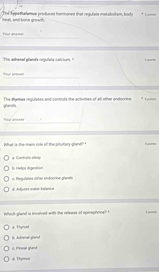 The hypothalamus produces hormones that regulate metabolism, body 5 points
heat, and bone growth.
Your answer
The adrenal glands regulate calcium. * 5 points
Your answer
The thymus regulates and controls the activities of all other endocrine. S points
glands.
Your answer
What is the main role of the pituitary gland? * 5 points
a. Controls sleep
b. Helps digestion
c. Regulates other endocrine glands
d. Adjusts water balance
Which gland is involved with the release of epinephrine? * S points
a. Thyroid
b. Adrenal gland
c. Pineal gland
d. Thymus