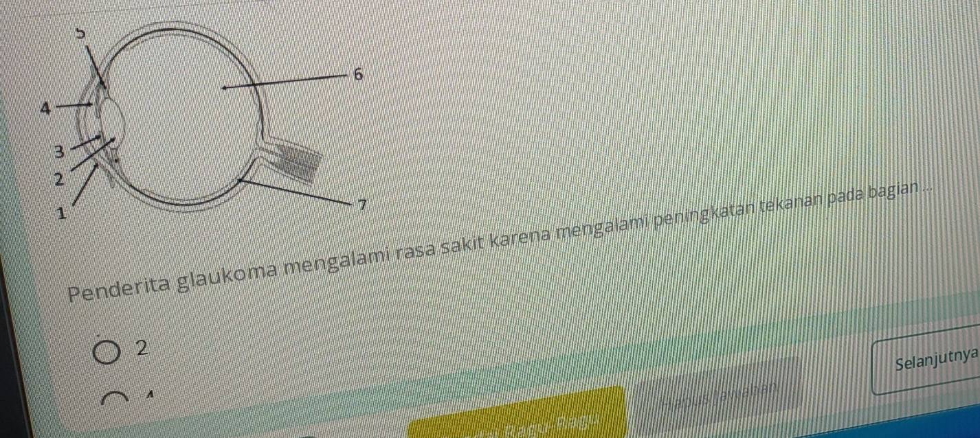 Penderita glaukoma mengalami rasa sakit karena mengalami peningkatan tekanan pada bagian ... 
2 
Selanjutnya 
A 
Naban