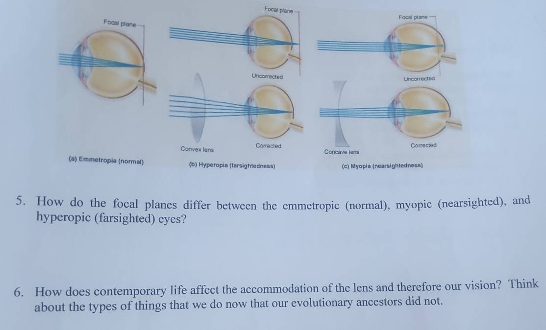 Focal p 
5. How do the focal planes differ between the emmetropic (normal), myopic (nearsighted), and 
hyperopic (farsighted) eyes? 
6. How does contemporary life affect the accommodation of the lens and therefore our vision? Think 
about the types of things that we do now that our evolutionary ancestors did not.