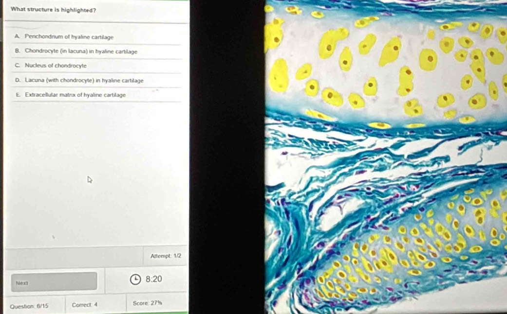 What structure is highlighted?
A Penchondrium of hyaline cartilage
B. Chondrocyte (in lacuna) in hyaline cartilage
C. Nucleus of chondrocyte
D. Lacuna (with chondrocyte) in hyaline cartilage
E. Extracellular matrix of hyaline cartilage
Attempt: 1/2
Next
8:20 
Question: 6/15 Correct 4 Score: 27%