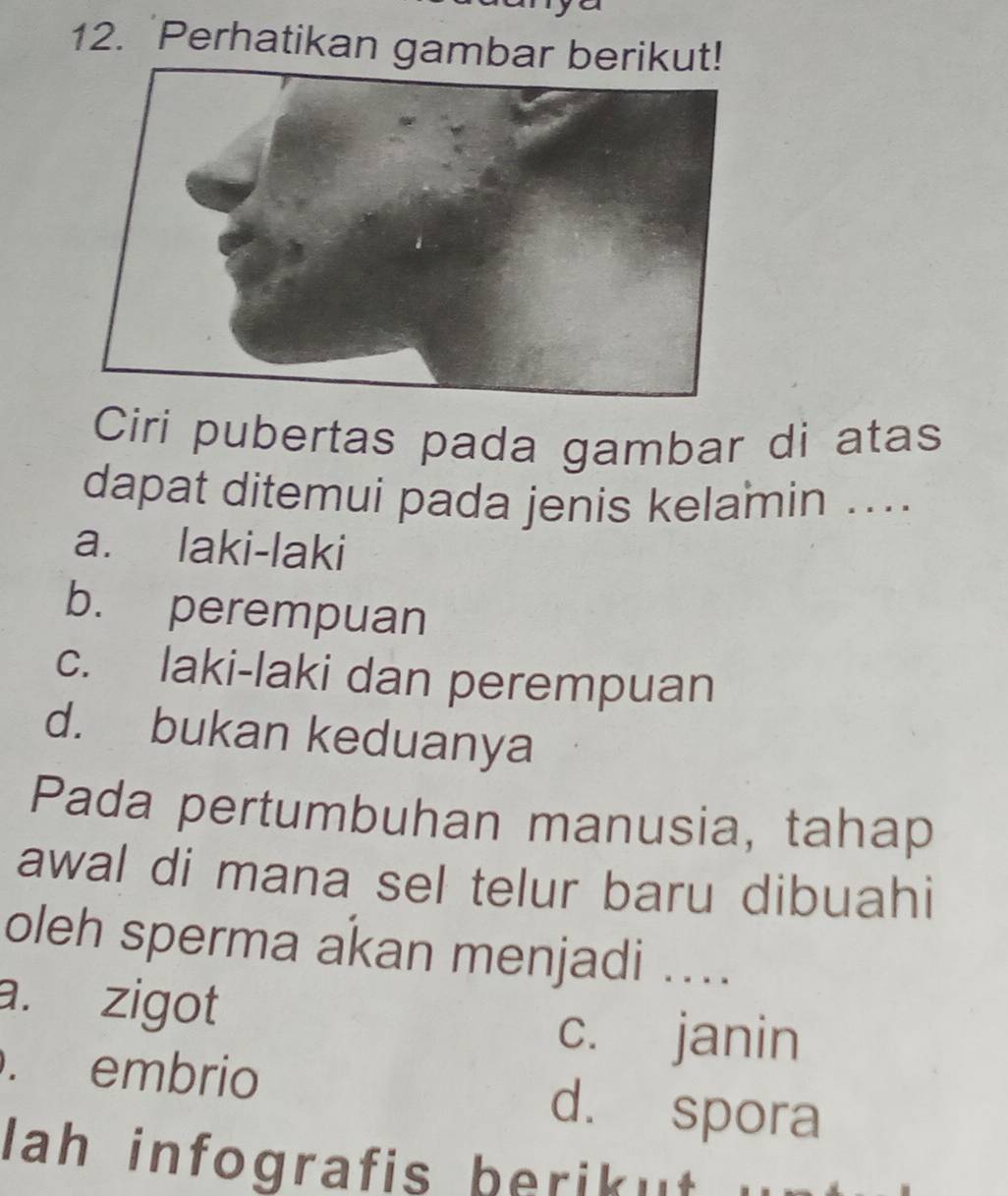 'Perhatikan gambar berikut!
Ciri pubertas pada gambar di atas
dapat ditemui pada jenis kelamin ...
a. laki-laki
b. perempuan
c. laki-laki dan perempuan
d. bukan keduanya
Pada pertumbuhan manusia, tahap
awal di mana sel telur baru dibuahi
oleh sperma akan menjadi ....
a. zigot
c. janin. embrio d. spora
Jah infografis berikut