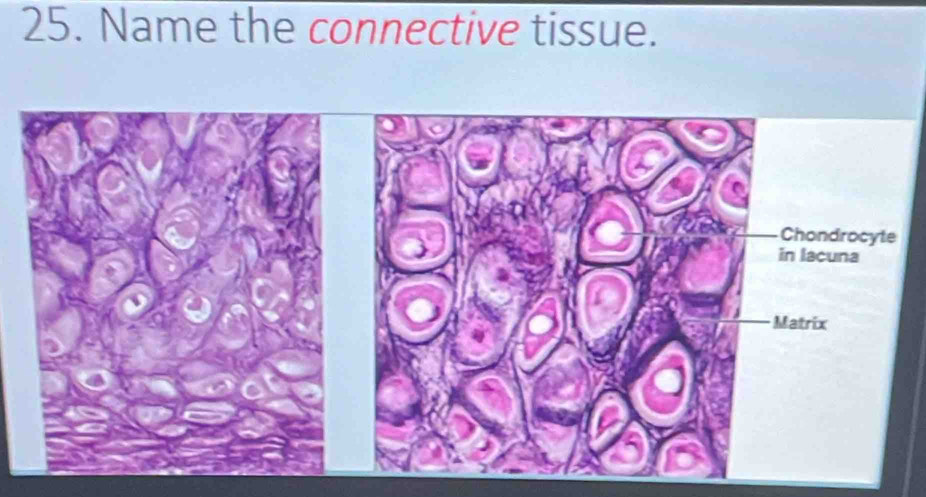 Name the connective tissue.