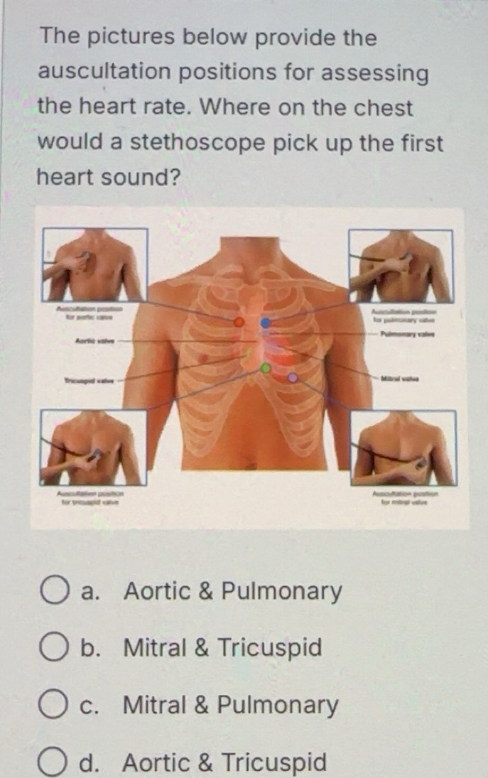 تم الحل:The pictures below provide the auscultation positions for ...