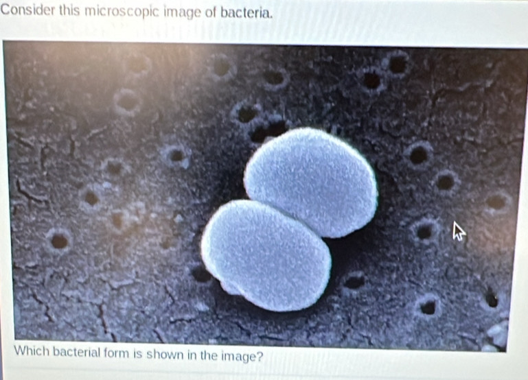 Consider this microscopic image of bacteria. 
W