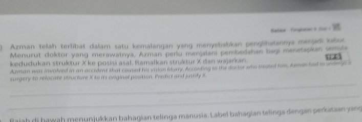 Medaa Togisten 9 166 1 
) Azman telah terlibat dalam satu kemalangan yang menyebabkan penglihatannya menjad bur 
Menurut doktor yang merawatnya, Azman perlu menjalani pembedshan bagi menetapkan semua 
kedudukan struktur X ke posisi asal, Ramalkan struktur X dan wajarkan. 
Azman was involved in an accident that caused his vision blurry. According to the doctor who treosed him, Arman had to undergo s i 
_ 
surgery to relocate structure X to its original position. Predict and justify X. 
_ 
Rajah di bawah menunjukkan bahagian telinga manusia. Label bahagian telinga dengan perkataan yang