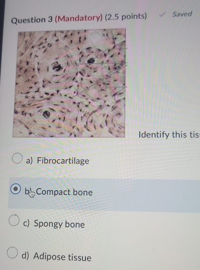 (Mandatory) (2.5 points) Saved
Identify this tis
a) Fibrocartilage
b Compact bone
c) Spongy bone
d) Adipose tissue