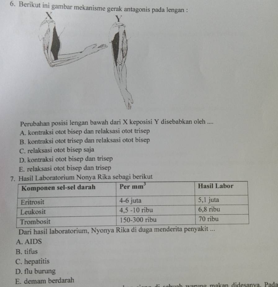 Berikut ini gambar mekanismenis pada lengan :
Perubahan posisi lengan bawah dari X keposisi Y disebabkan oleh ....
A. kontraksi otot bisep dan relaksasi otot trisep
B. kontraksi otot trisep dan relaksasi otot bisep
C. relaksasi otot bisep saja
D. kontraksi otot bisep dan trisep
E. relaksasi otot bisep dan trisep
7. Hasil Laboratorium Nonya Rika sebagi berikut
Dari hasil laboratorium, Nyonya Rika di duga menderita pen
A. AIDS
B. tifus
C. hepatitis
D. flu burung
E. demam berdarah
warung makan didesanva. Pada