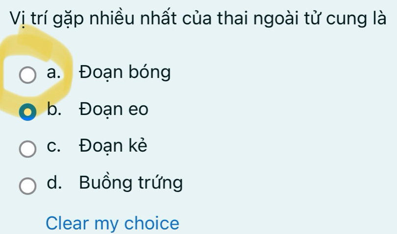 Vị trí gặp nhiều nhất của thai ngoài tử cung là
a. Đoạn bóng
b. Đoạn eo
c. Đoạn kẻ
d. Buồng trứng
Clear my choice