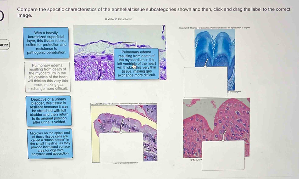 Solved: Compare the specific characteristics of the epithelial tissue ...