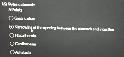 Pyloric stenosis:
5 Points
Gastric ulcer
Narrowing of the opening between the stomach and intestine
Hiatal hernia
Cardiospasm
Achalasia