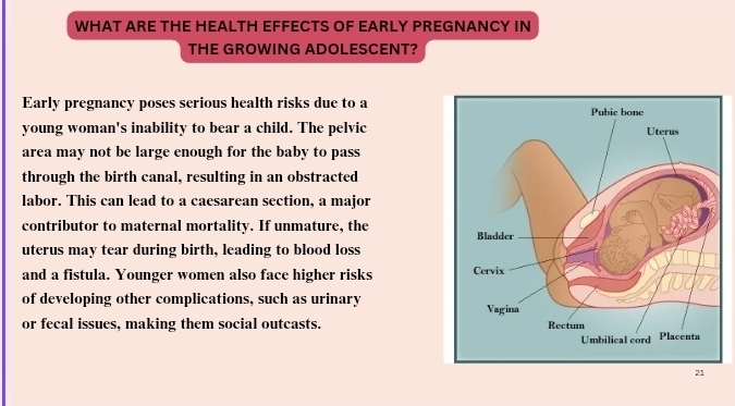 WHAT ARE THE HEALTH EFFECTS OF EARLY PREGNANCY IN 
THE GROWING ADOLESCENT? 
Early pregnancy poses serious health risks due to a 
young woman's inability to bear a child. The pelvic 
area may not be large enough for the baby to pass 
through the birth canal, resulting in an obstracted 
labor. This can lead to a caesarean section, a major 
contributor to maternal mortality. If unmature, the 
uterus may tear during birth, leading to blood loss 
and a fistula. Younger women also face higher risks 
of developing other complications, such as urinary 
or fecal issues, making them social outcasts.