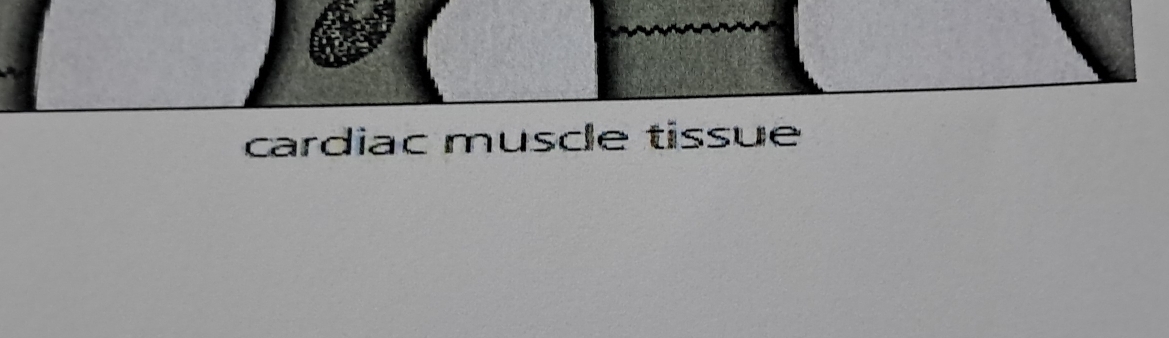 cardiac musce tissue