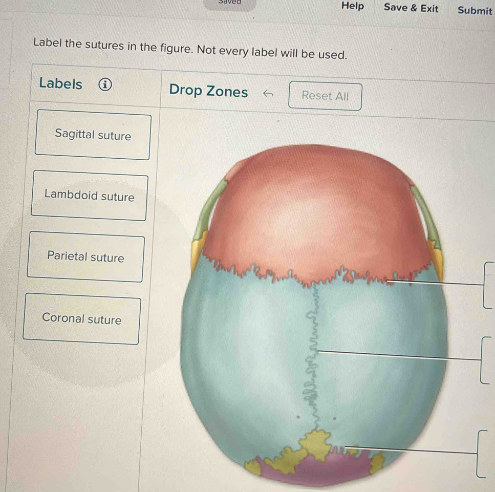 Solved: saved Help Save & Exit Submit Label the sutures in the figure ...