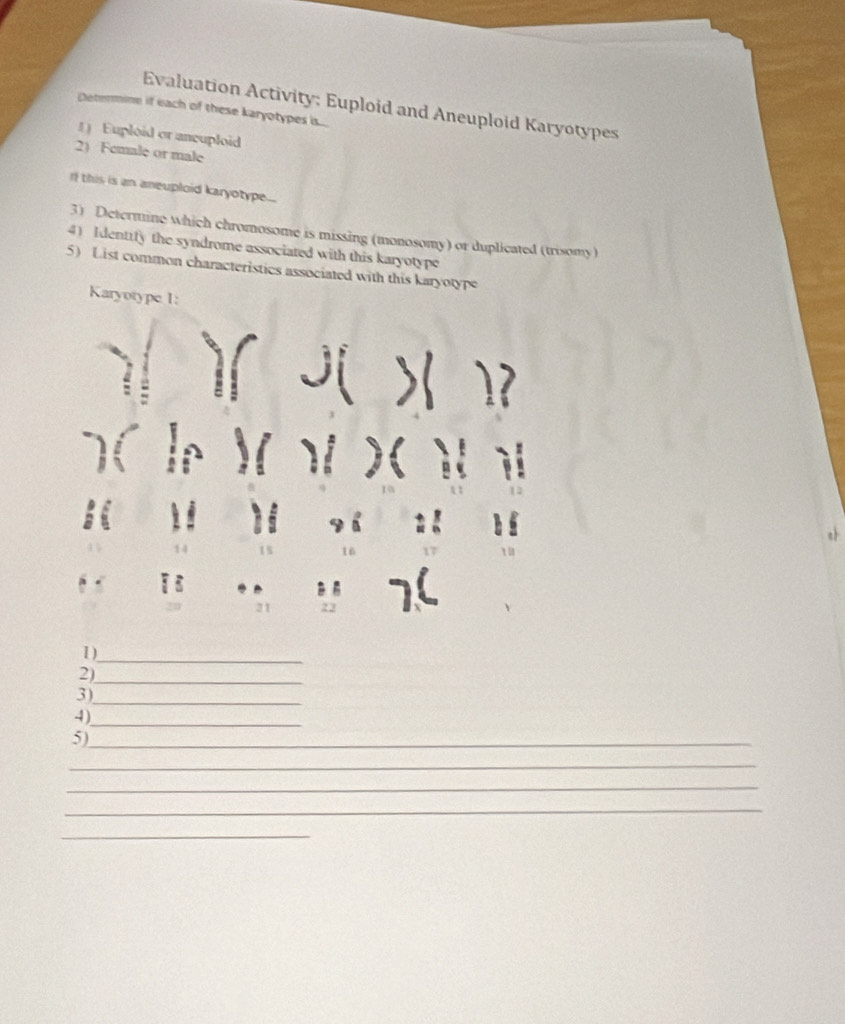 Evaluation Activity: Euploid and Aneuploid Karyotypes 
Determine if each of these karyotypes is... 
() Euploid or ancuploid 
2) Female or male 
If this is an aneuploid karyotype... 
3) Determine which chromosome is missing (monosomy) or duplicated (trisomy) 
4) Identify the syndrome associated with this karyotype 
5) List common characteristics associated with this karyotype 
Karyotype 1: 
A 
21 
1 )_ 
2)_ 
3) 
_ 
4)_ 
5)_ 
_ 
_ 
_ 
_