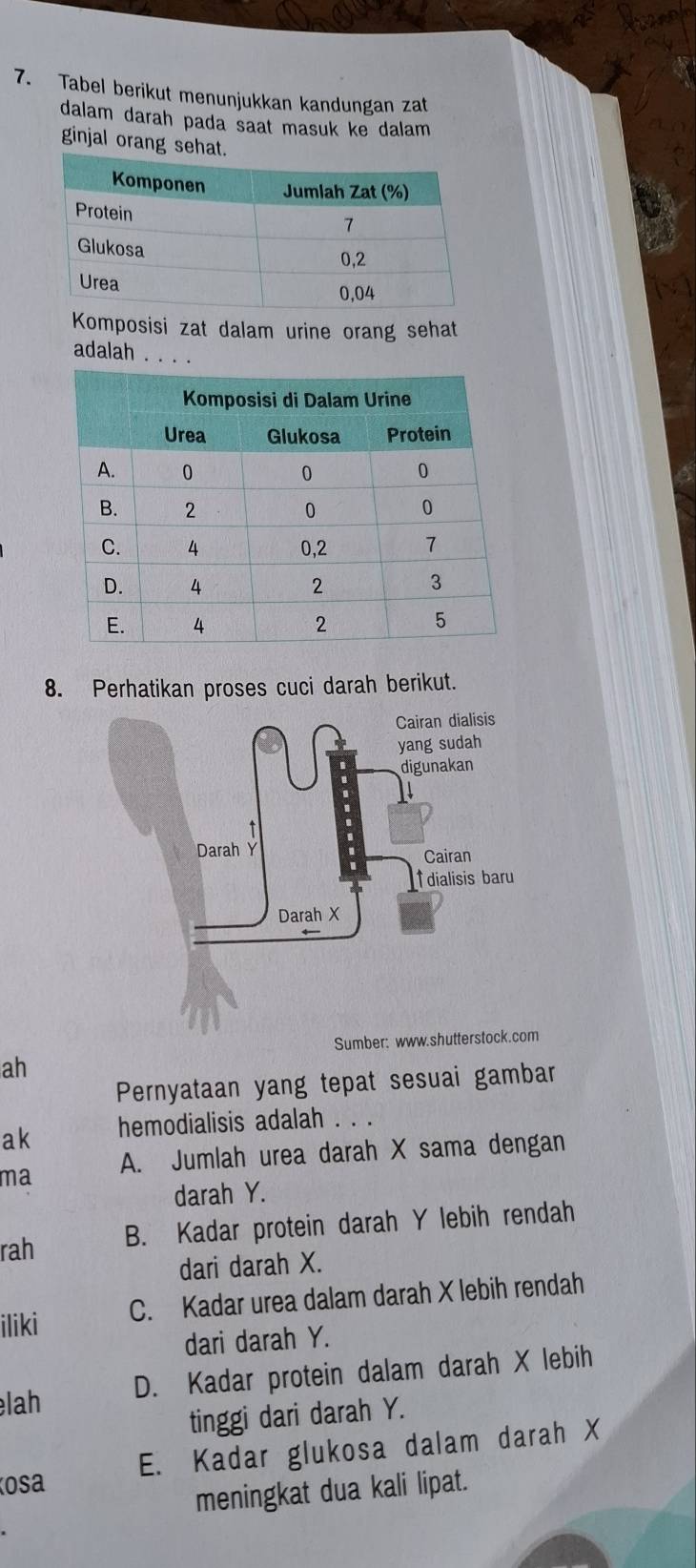 Tabel berikut menunjukkan kandungan zat
dalam darah pada saat masuk ke dalam
ginjal orang sehat.
Komposisi zat dalam urine orang sehat
adalah_
8. Perhatikan proses cuci darah berikut.
Sumber: www.shuttersto
ah
Pernyataan yang tepat sesuai gambar
ak hemodialisis adalah . . .
ma A. Jumlah urea darah X sama dengan
darah Y.
rah B. Kadar protein darah Y lebih rendah
dari darah X.
iliki C. Kadar urea dalam darah X lebih rendah
dari darah Y.
D. Kadar protein dalam darah X lebih
lah
tinggi dari darah Y.
E. Kadar glukosa dalam darah X
osa
meningkat dua kali lipat.