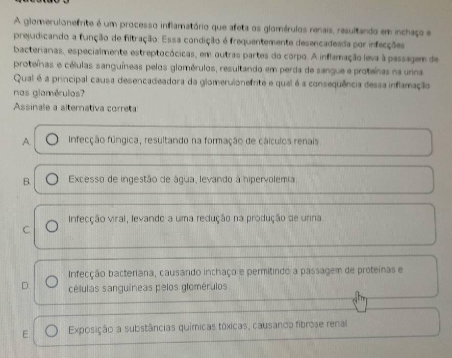 A glomerulonefrite é um processo inflamatório que afeta os glomérulos renais, resultando em inchaço e
prejudicando a função de filtração. Essa condição é frequentemente desencadeada por infecções
bacterianas, especialmente estreptocócicas, em outras partes do corpo. A inflamação leva à passagem de
proteínas e células sanguíneas pelos glomérulos, resultando em perda de sangue e proteínas na urina
Qual é a principal causa desencadeadora da glomerulonefrite e qual é a consequência dessa inflamação
nos glomérulos?
Assinale a alternativa correta:
A. Infecção fúngica, resultando na formação de cálculos renais.
B. Excesso de ingestão de água, levando à hipervolemia.
Infecção viral, levando a uma redução na produção de urina.
C.
Infecção bacteriana, causando inchaço e permitindo a passagem de proteínas e
D. células sanguíneas pelos glomérulos.
E. Exposição a substâncias químicas tóxicas, causando fibrose renal