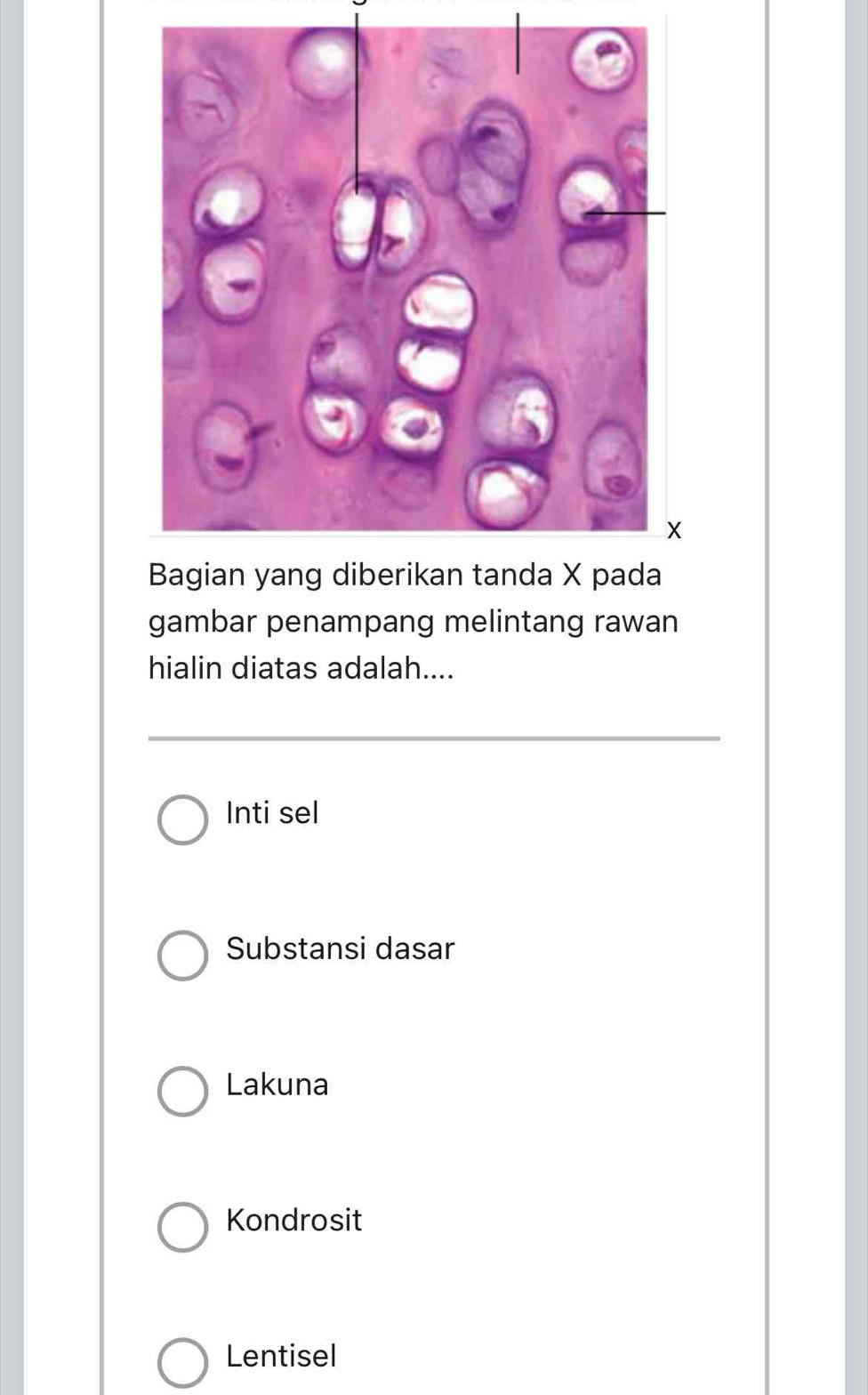 gambar penampang melintang rawan
hialin diatas adalah....
Inti sel
Substansi dasar
Lakuna
Kondrosit
Lentisel