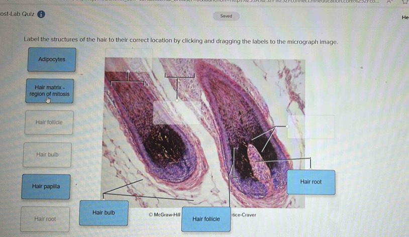 Solved: ost-Lab Quiz Saved He Label the structures of the hair to their ...