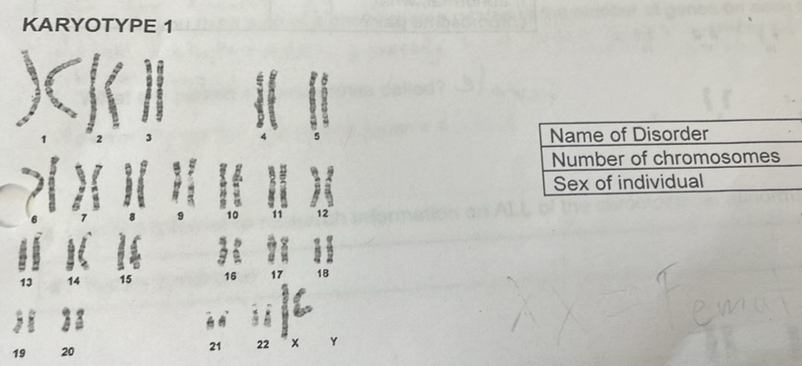 KARYOTYPE 1
14
22
19 20