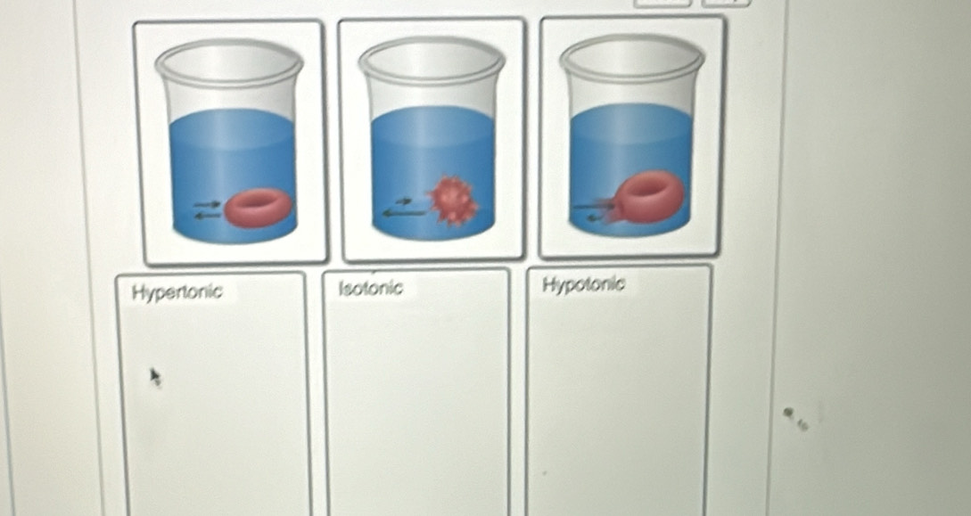 Hypertonic Isotonic Hypotonic