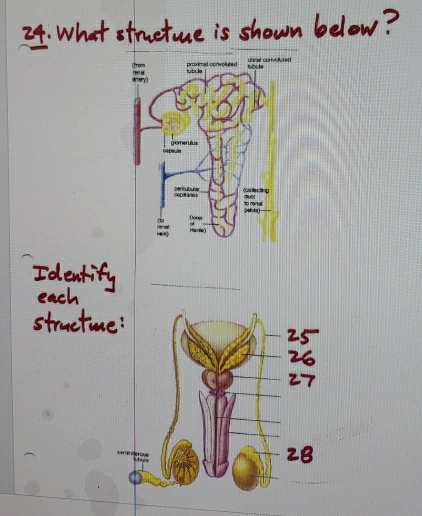 What stre fe is shown below ? 
_ 
_
28