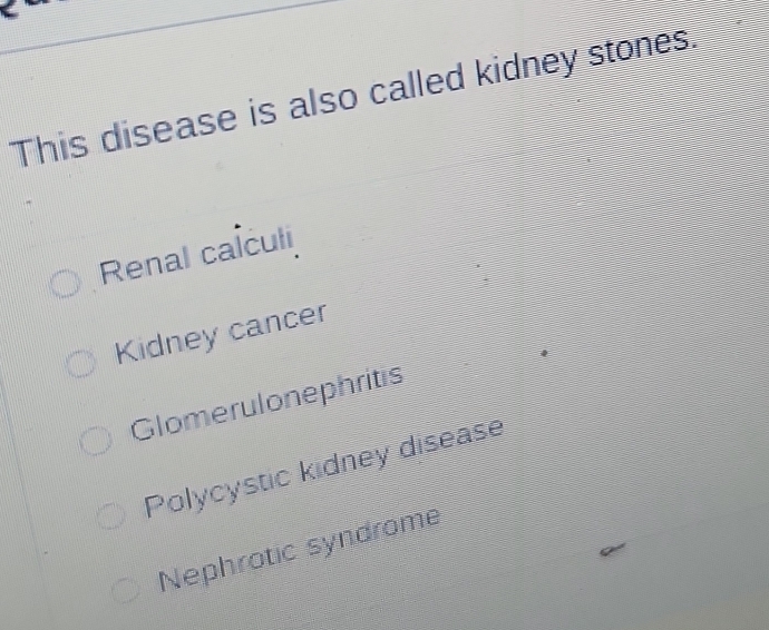 This disease is also called kidney stones.
Renal calculi
Kidney cancer
Glomerulonephritis
Polycystic kidney disease
Nephrotic syndrome