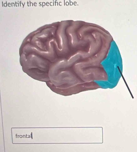 Identify the specific lobe.
frontal