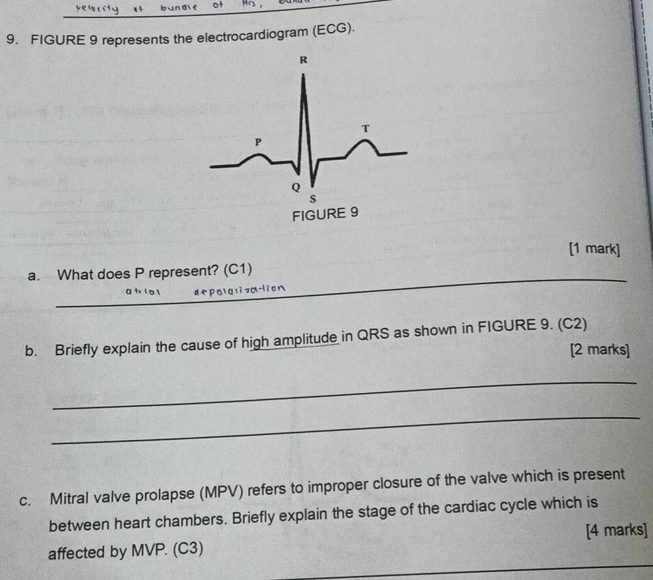 vewrity st bundle of 
_ 
9. FIGURE 9 represents the electrocardiogram (ECG). 
[1 mark] 
_ 
a. What does P represent? (C1) 
de po g li za lion 
b. Briefly explain the cause of high amplitude in QRS as shown in FIGURE 9. (C2) 
[2 marks] 
_ 
_ 
c. Mitral valve prolapse (MPV) refers to improper closure of the valve which is present 
between heart chambers. Briefly explain the stage of the cardiac cycle which is 
[4 marks] 
_ 
affected by MVP. (C3)