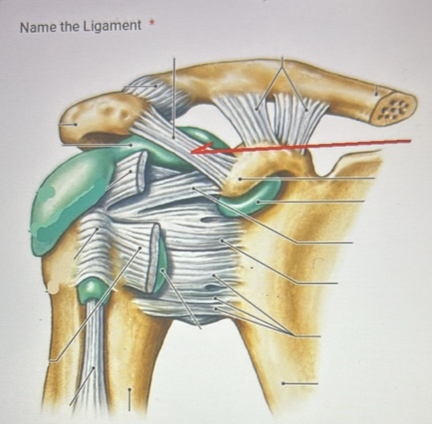 Name the Ligament *