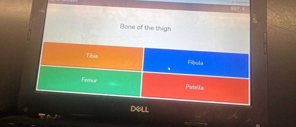 887
Bone of the thigh 
Tibia Fibula 

Femur Patella