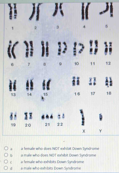 2 3 4 5
6 7 8 9 10 11 12
13 14 15 16 17 18
19 20 21 22
x Y
a a female who does NOT exhibit Down Syndrome
b a male who does NOT exhibit Down Syndrome
C a female who exhibits Down Syndrome
d a male who exhibits Down Syndrome