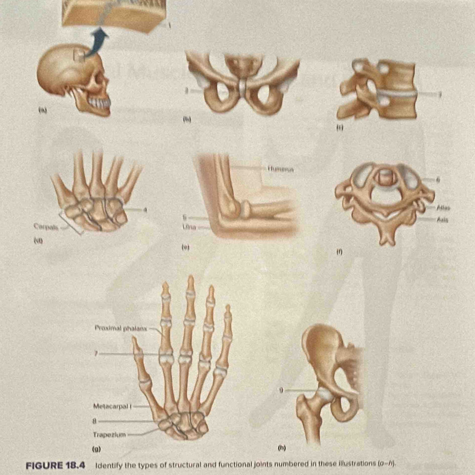 Solved: 9 (h) FIGURE 18.4 Identify the types of structural and ...